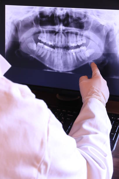 Best Emergency Tooth Extraction in Appomattox, VA